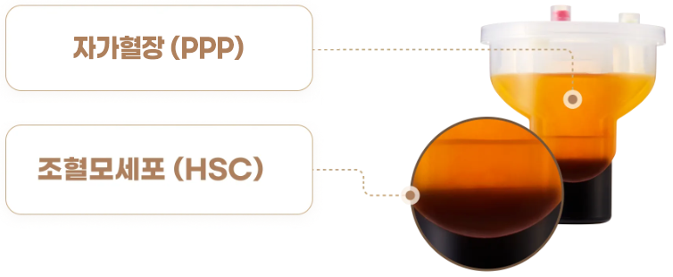 자가혈장(PPP), 조혈모세포(HSC) 이미지