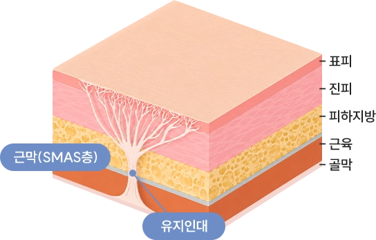 근막(SMAS층)의 구조 : 유지인대가 가운데를 지탱하고, 아래쪽에서부터 골막, 근육, 피하지방, 진피, 표피의 층이 있음